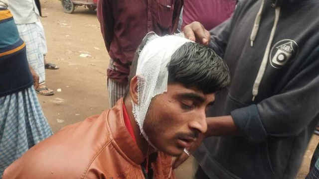 আশুলিয়ায় ময়লার গাড়ি আটকিয়ে দেশীয় অস্ত্র দিয়ে পিটিয়ে জখম
